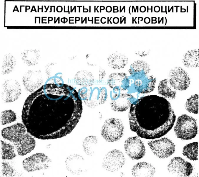 Агранулоциты крови (моноциты периферической крови)