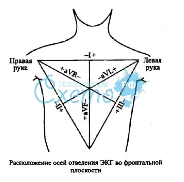 Расположение осей отведения ЭКГ во фронтальной плоскости