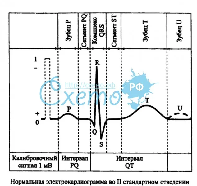 Нормальная электрокардиограмма во II стандартном отведении