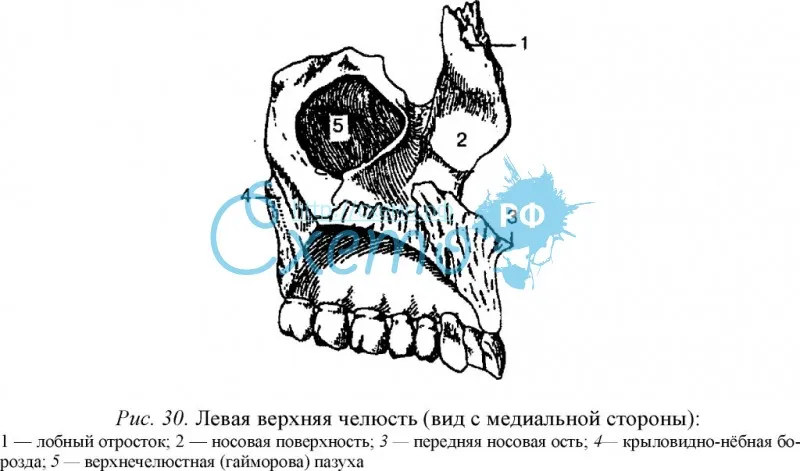 Левая верхняя челюсть (вид с медиальной стороны)
