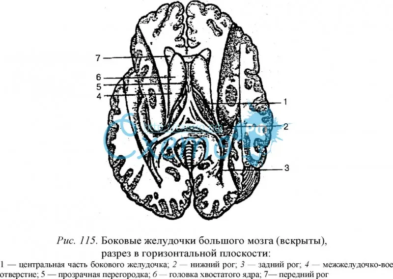 Боковые желудочки большого мозга (вскрыты), разрез в горизонтальной плоскости