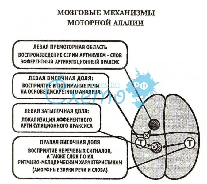 Моторная алалия (мозговые механизмы)